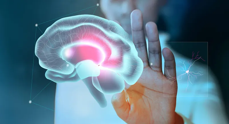 Multiple sclerosis (MS) and CBD oil
